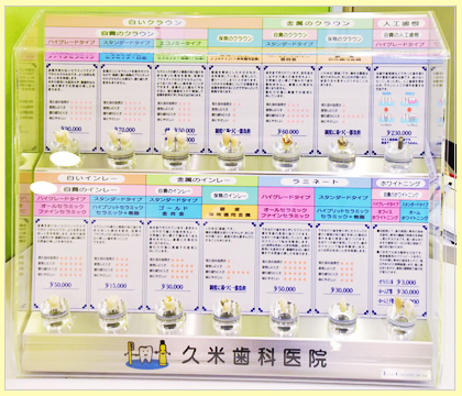 インレー(詰め物 )とクラウン(差し歯、被せ物 )について