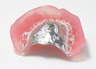 金属床義歯（総入れ歯）